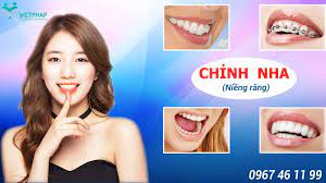 Dịch vụ 4